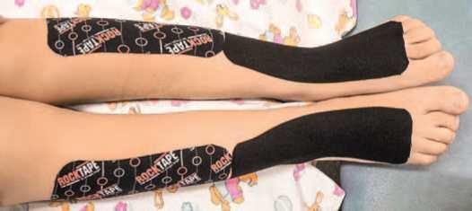 Иллюстрация к книге — Кинезиотейпинг в лечебной практике неврологии и ортопедии [i_127.jpg]