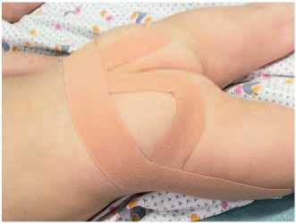 Иллюстрация к книге — Кинезиотейпинг в лечебной практике неврологии и ортопедии [i_135.jpg]