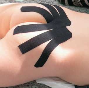 Иллюстрация к книге — Кинезиотейпинг в лечебной практике неврологии и ортопедии [i_138.jpg]