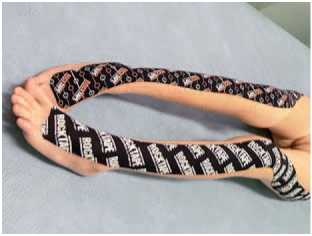 Иллюстрация к книге — Кинезиотейпинг в лечебной практике неврологии и ортопедии [i_144.jpg]