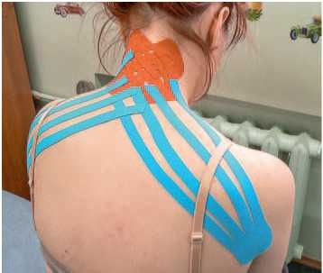 Иллюстрация к книге — Кинезиотейпинг в лечебной практике неврологии и ортопедии [i_146.jpg]