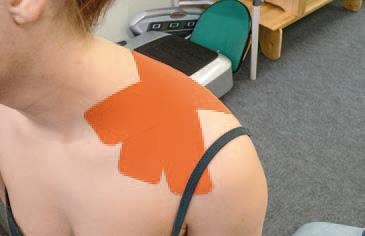 Иллюстрация к книге — Кинезиотейпинг в лечебной практике неврологии и ортопедии [i_150.jpg]