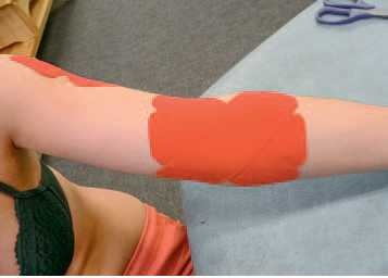 Иллюстрация к книге — Кинезиотейпинг в лечебной практике неврологии и ортопедии [i_152.jpg]