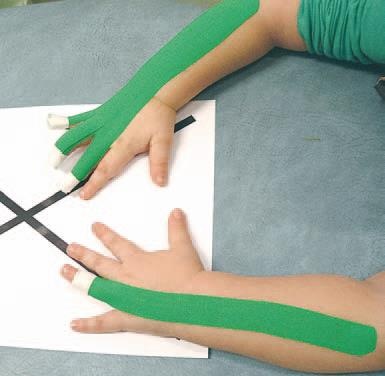 Иллюстрация к книге — Кинезиотейпинг в лечебной практике неврологии и ортопедии [i_154.jpg]