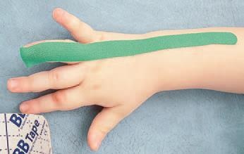 Иллюстрация к книге — Кинезиотейпинг в лечебной практике неврологии и ортопедии [i_155.jpg]