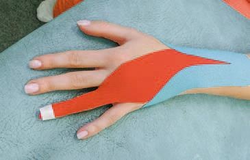 Иллюстрация к книге — Кинезиотейпинг в лечебной практике неврологии и ортопедии [i_157.jpg]