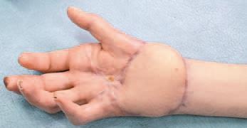 Иллюстрация к книге — Кинезиотейпинг в лечебной практике неврологии и ортопедии [i_160.jpg]