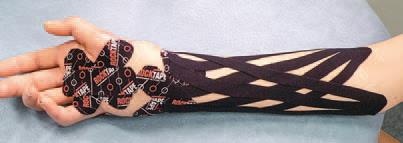 Иллюстрация к книге — Кинезиотейпинг в лечебной практике неврологии и ортопедии [i_162.jpg]