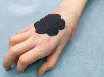 Иллюстрация к книге — Кинезиотейпинг в лечебной практике неврологии и ортопедии [i_164.jpg]