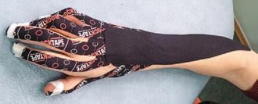 Иллюстрация к книге — Кинезиотейпинг в лечебной практике неврологии и ортопедии [i_166.jpg]