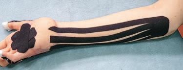 Иллюстрация к книге — Кинезиотейпинг в лечебной практике неврологии и ортопедии [i_167.jpg]