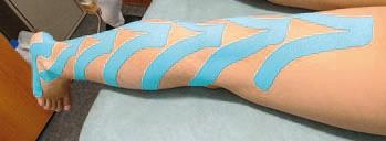 Иллюстрация к книге — Кинезиотейпинг в лечебной практике неврологии и ортопедии [i_169.jpg]