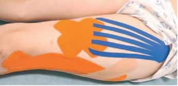 Иллюстрация к книге — Кинезиотейпинг в лечебной практике неврологии и ортопедии [i_170.jpg]