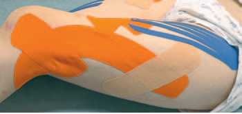 Иллюстрация к книге — Кинезиотейпинг в лечебной практике неврологии и ортопедии [i_171.jpg]