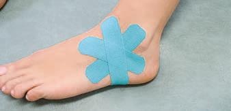 Иллюстрация к книге — Кинезиотейпинг в лечебной практике неврологии и ортопедии [i_176.jpg]