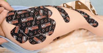 Иллюстрация к книге — Кинезиотейпинг в лечебной практике неврологии и ортопедии [i_177.jpg]