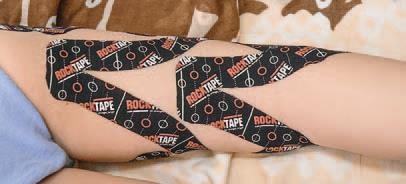 Иллюстрация к книге — Кинезиотейпинг в лечебной практике неврологии и ортопедии [i_179.jpg]