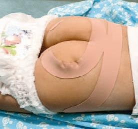 Иллюстрация к книге — Кинезиотейпинг в лечебной практике неврологии и ортопедии [i_181.jpg]