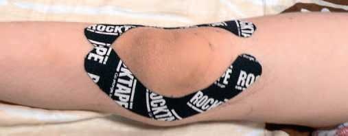 Иллюстрация к книге — Кинезиотейпинг в лечебной практике неврологии и ортопедии [i_182.jpg]