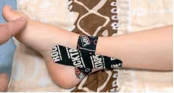 Иллюстрация к книге — Кинезиотейпинг в лечебной практике неврологии и ортопедии [i_183.jpg]