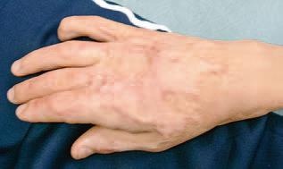 Иллюстрация к книге — Кинезиотейпинг в лечебной практике неврологии и ортопедии [i_190.jpg]