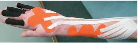 Иллюстрация к книге — Кинезиотейпинг в лечебной практике неврологии и ортопедии [i_193.jpg]