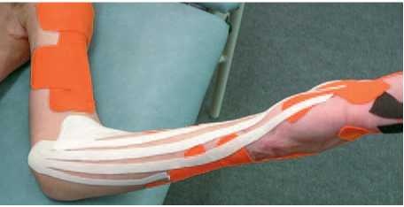 Иллюстрация к книге — Кинезиотейпинг в лечебной практике неврологии и ортопедии [i_194.jpg]