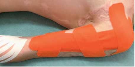 Иллюстрация к книге — Кинезиотейпинг в лечебной практике неврологии и ортопедии [i_195.jpg]