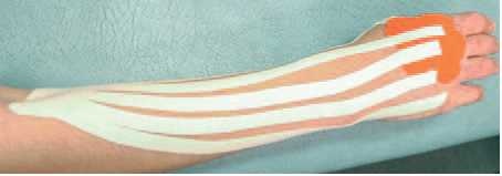 Иллюстрация к книге — Кинезиотейпинг в лечебной практике неврологии и ортопедии [i_196.jpg]