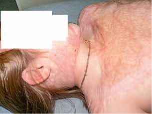 Иллюстрация к книге — Кинезиотейпинг в лечебной практике неврологии и ортопедии [i_198.jpg]