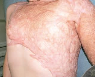 Иллюстрация к книге — Кинезиотейпинг в лечебной практике неврологии и ортопедии [i_199.jpg]