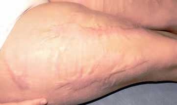 Иллюстрация к книге — Кинезиотейпинг в лечебной практике неврологии и ортопедии [i_203.jpg]