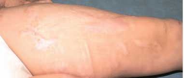 Иллюстрация к книге — Кинезиотейпинг в лечебной практике неврологии и ортопедии [i_204.jpg]