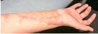 Иллюстрация к книге — Кинезиотейпинг в лечебной практике неврологии и ортопедии [i_205.jpg]