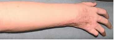 Иллюстрация к книге — Кинезиотейпинг в лечебной практике неврологии и ортопедии [i_206.jpg]