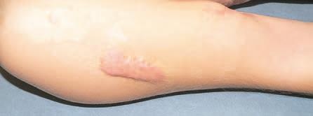 Иллюстрация к книге — Кинезиотейпинг в лечебной практике неврологии и ортопедии [i_209.jpg]