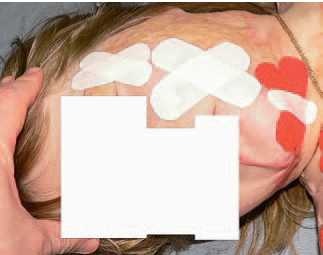 Иллюстрация к книге — Кинезиотейпинг в лечебной практике неврологии и ортопедии [i_210.jpg]