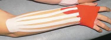 Иллюстрация к книге — Кинезиотейпинг в лечебной практике неврологии и ортопедии [i_214.jpg]