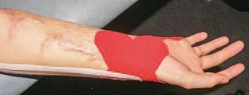 Иллюстрация к книге — Кинезиотейпинг в лечебной практике неврологии и ортопедии [i_215.jpg]