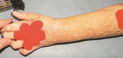 Иллюстрация к книге — Кинезиотейпинг в лечебной практике неврологии и ортопедии [i_218.jpg]