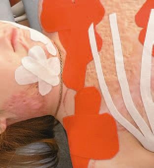 Иллюстрация к книге — Кинезиотейпинг в лечебной практике неврологии и ортопедии [i_220.jpg]