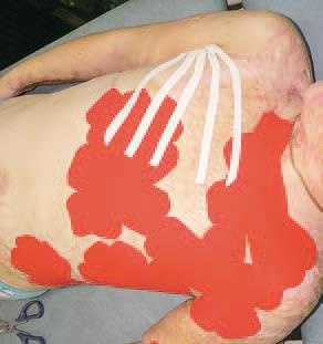 Иллюстрация к книге — Кинезиотейпинг в лечебной практике неврологии и ортопедии [i_221.jpg]