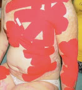 Иллюстрация к книге — Кинезиотейпинг в лечебной практике неврологии и ортопедии [i_227.jpg]