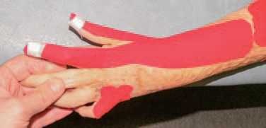 Иллюстрация к книге — Кинезиотейпинг в лечебной практике неврологии и ортопедии [i_233.jpg]