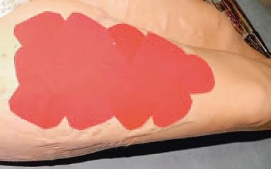 Иллюстрация к книге — Кинезиотейпинг в лечебной практике неврологии и ортопедии [i_234.jpg]