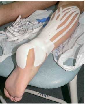 Иллюстрация к книге — Кинезиотейпинг в лечебной практике неврологии и ортопедии [i_239.jpg]