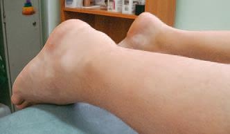 Иллюстрация к книге — Кинезиотейпинг в лечебной практике неврологии и ортопедии [i_241.jpg]