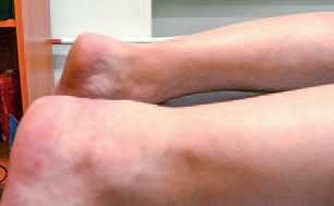 Иллюстрация к книге — Кинезиотейпинг в лечебной практике неврологии и ортопедии [i_242.jpg]