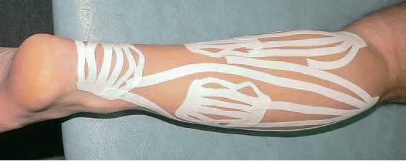 Иллюстрация к книге — Кинезиотейпинг в лечебной практике неврологии и ортопедии [i_244.jpg]