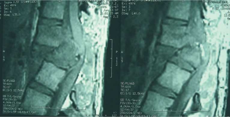 Иллюстрация к книге — Кинезиотейпинг в лечебной практике неврологии и ортопедии [i_248.jpg]